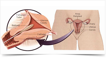 Embryo Fertility Centre Jalandhar