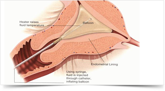 Embryo Fertility Centre Hoshiarpur