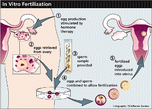 IVF Treatment Jalandhar,Infertility Clinic,IVF Clinic Cost in Punjab 